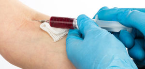 quimica-sanguinea-estudio